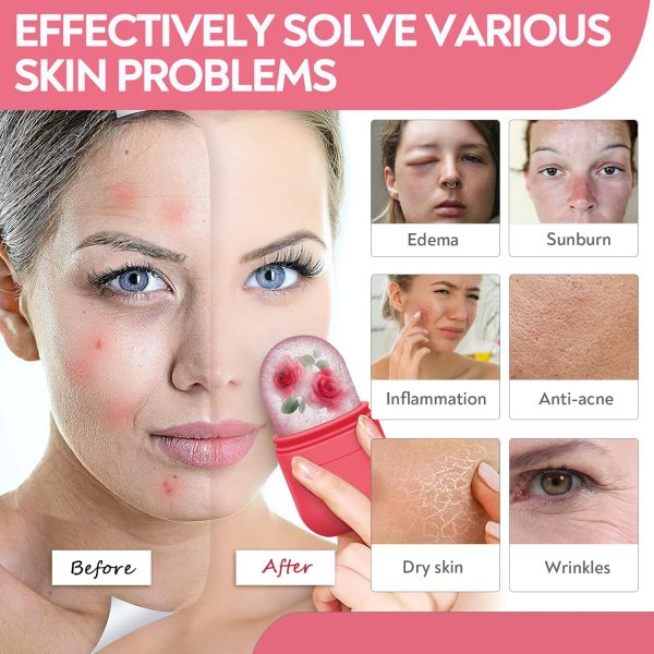 AURUZA Ice Face Roller and Gua Sha Set, Ice Roller for Face & Eye Puffiness - Image 3