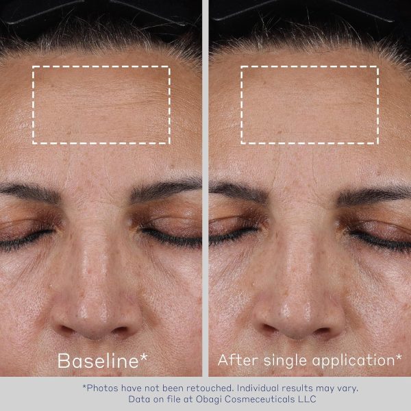 Obagi ELASTIderm Advanced Filler Concentrate – Clinically Proven - Image 5