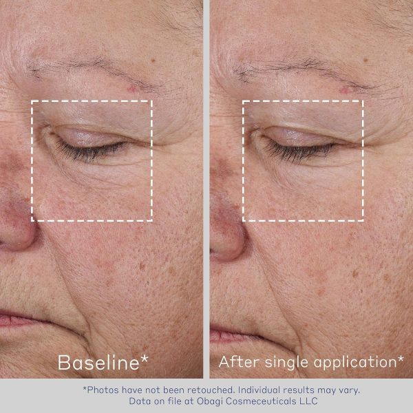 Obagi ELASTIderm Advanced Filler Concentrate – Clinically Proven - Image 3