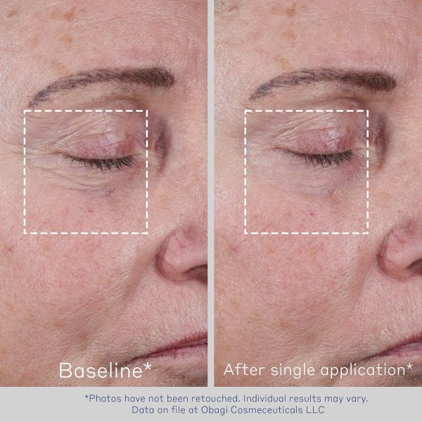 Obagi ELASTIderm Advanced Filler Concentrate – Clinically Proven - Image 4