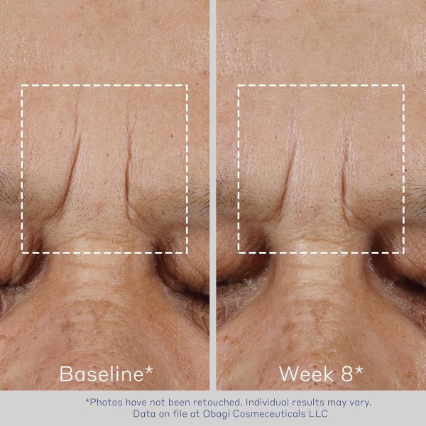 Obagi ELASTIderm Advanced Filler Concentrate – Clinically Proven - Image 6