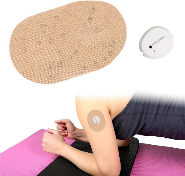 continuous glucose monitor