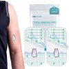 continuous glucose monitor