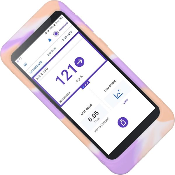 continuous glucose monitor