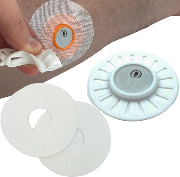 continuous glucose monitor