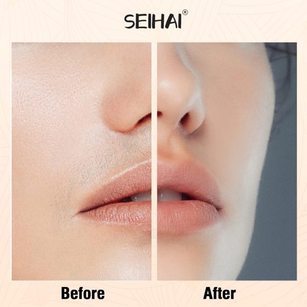 Hair Removal Device, Facial Hair Removal for Women, Rechargeable Hair - Image 6