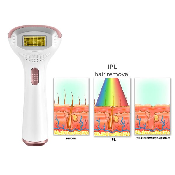 Aphrona® Hair Removal | For Full Body, Face, Sideburns, Stomach, Arms | - Image 3