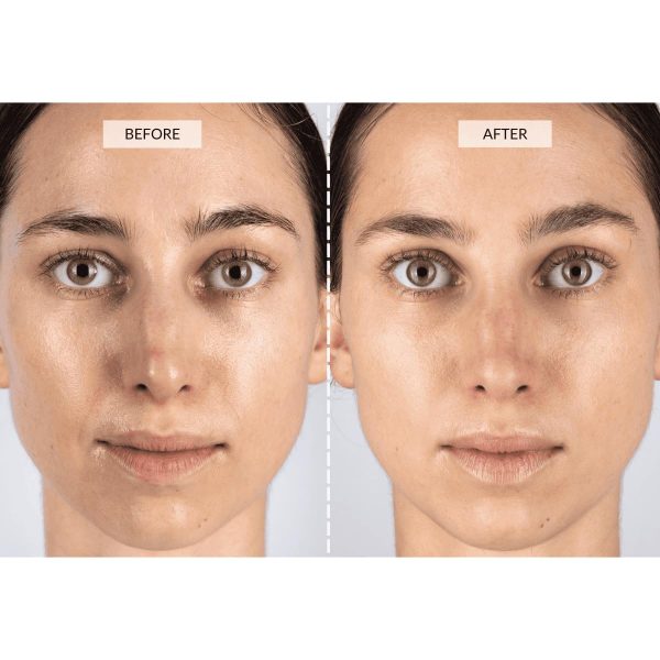 CurrentBody Skin LED Light Therapy Face Mask | Red Light Therapy Treatment - Image 7