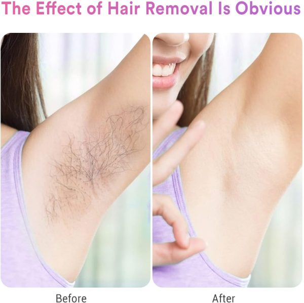 IPL Hair Removal for Women and Men, Ice-Cooling, Ice Painless Laser Hair - Image 2