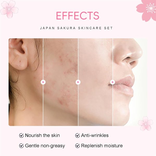 Sakura Skincare Set Facial Kit - Skin Care Gift Set for Girls/Women's, - Image 6