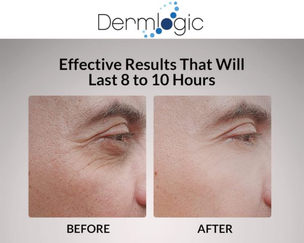 Under Eye Puffiness & Dark Circles Rapid Treatment- Instantly Reduces the - Image 4