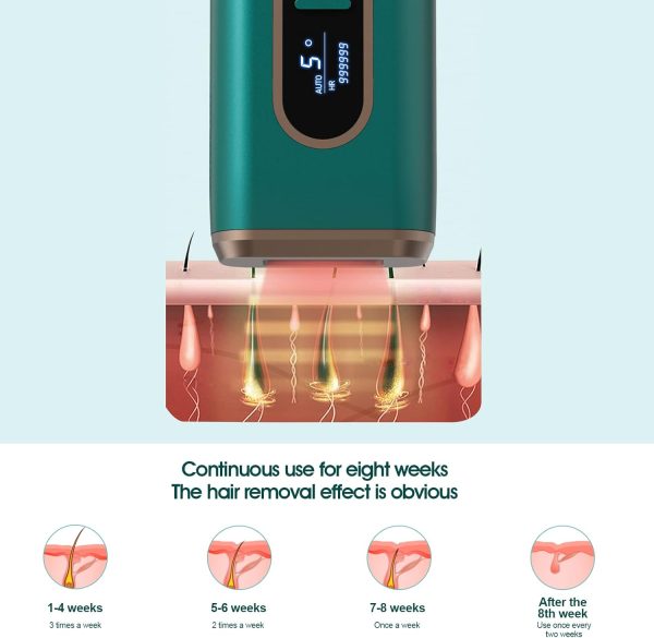 FENCY Laser Hair Removal Device for Women and Men, Cooling System, 5 Energy - Image 4
