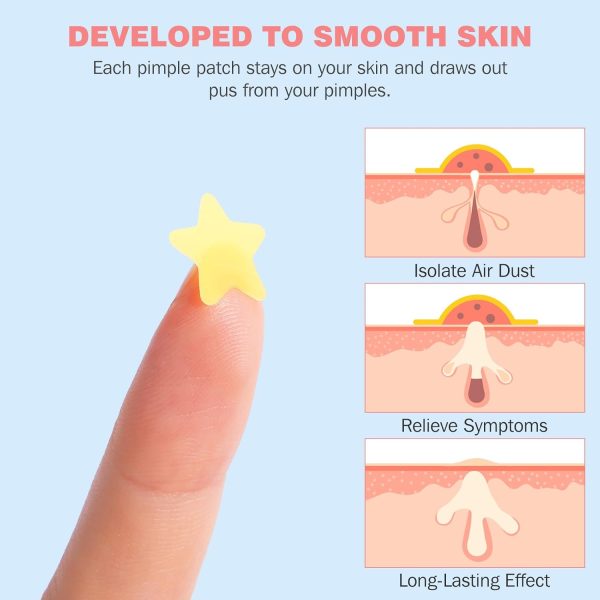 Pimple Patches for Face 360PCS, Hydrocolloid Acne Patches for Covering Zits - Image 2
