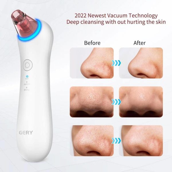 Blackhead Remover Pore Vacuum Extractor-2025 Upgrade GERY Blackhead Cleaner - Image 2
