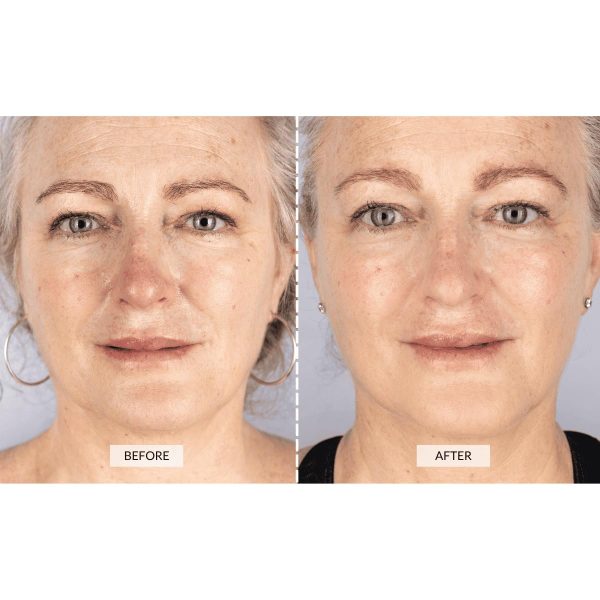 CurrentBody Skin LED Light Therapy Face Mask | Red Light Therapy Treatment - Image 3