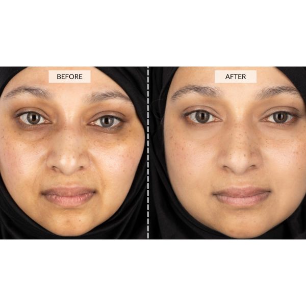 CurrentBody Skin LED Light Therapy Face Mask | Red Light Therapy Treatment - Image 6