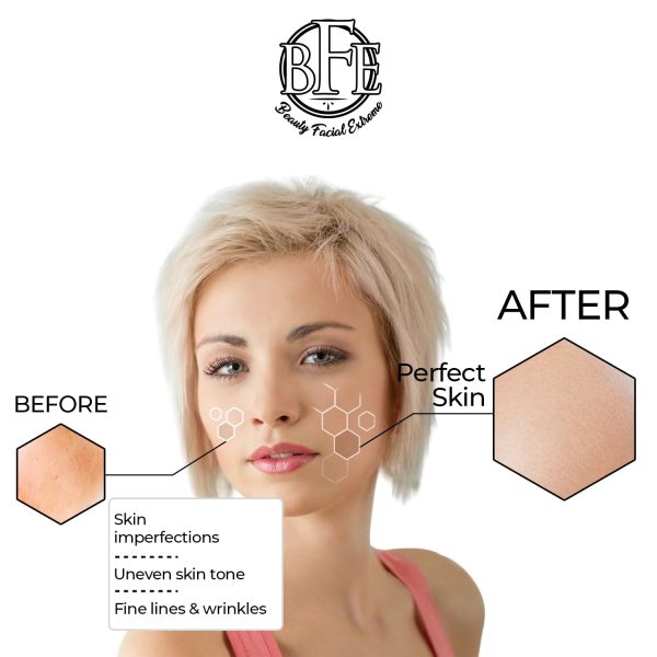 Anti Aging Resurfacing Exfoliating Peel Pads Treatment- Contains Lactic, - Image 6