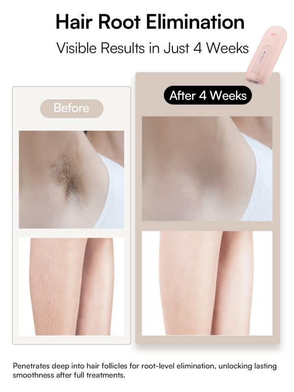 Laser Hair Removal Device for Women and Men, INIA Fond Hair Remover with - Image 3