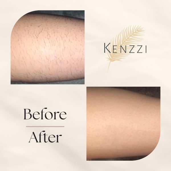 Kenzzi IPL Hair Removal Handset for Women & Men: Pain-Free & Long-lasting - Image 7