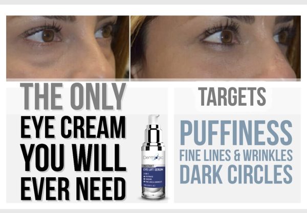 Under Eye Puffiness & Dark Circles Rapid Treatment- Instantly Reduces the - Image 6