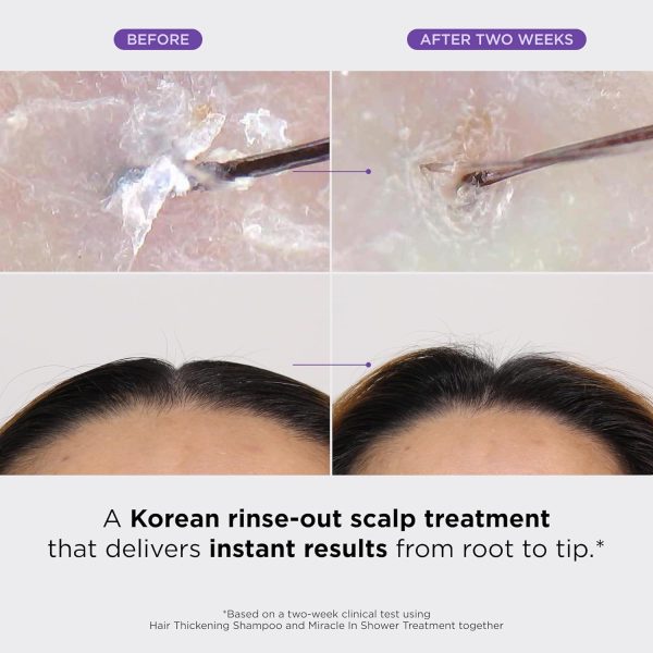 Dr. Groot Miracle in Shower Treatment for Hair Loss, Korean Hair Care, 5 - Image 2
