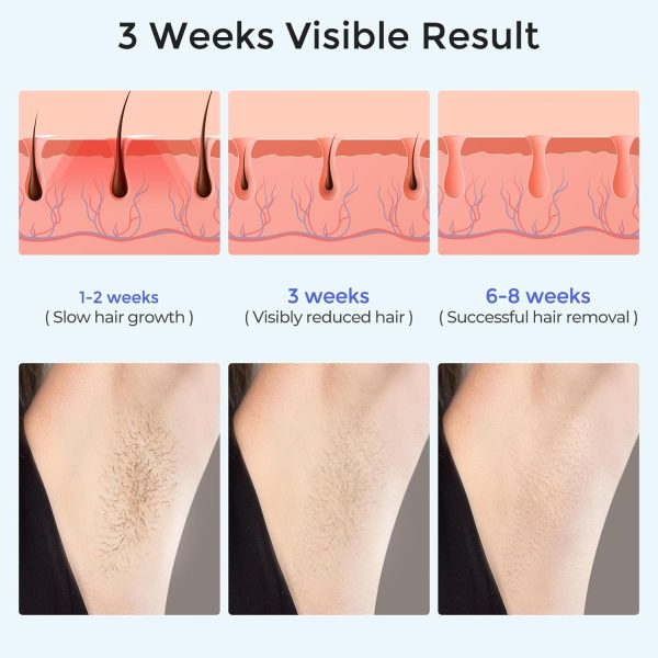 LUBEX Laser Hair Removal, IPL Hair Removal Device with Sapphire Ice-Cooling - Image 5