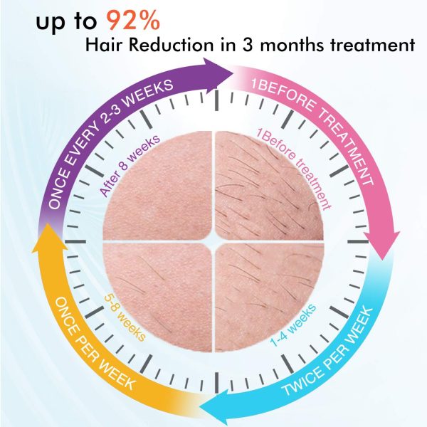 IMENE Permanent Hair Removal Machine for Women & Men, 500,000 Flashes IPL - Image 2