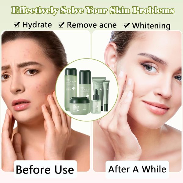 Avocado Skin Care Set for Women,6PCS Skincare Kits with Facial Cleanser, - Image 3