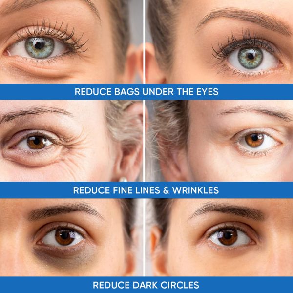 Under Eye Puffiness & Dark Circles Rapid Treatment- Instantly Reduces the - Image 3