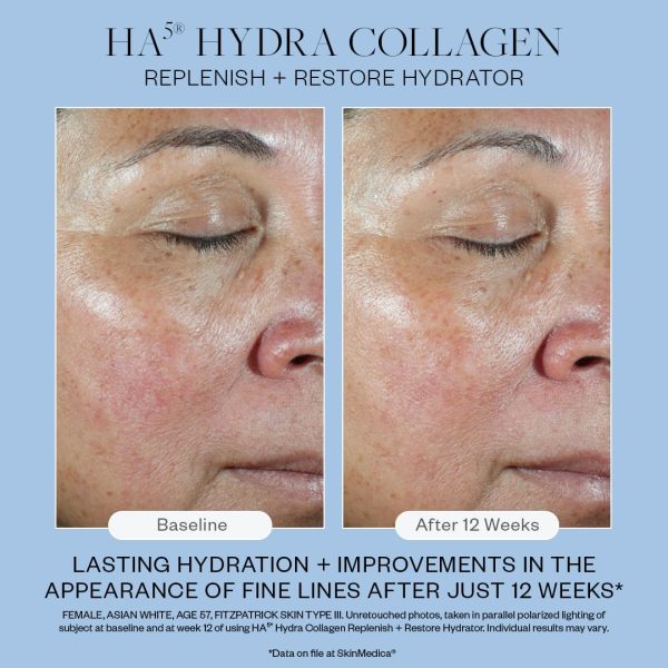 SkinMedica HA5 Hydra Collagen Replenish + Restore Hydrator – Next-Gen HA5 - Image 6