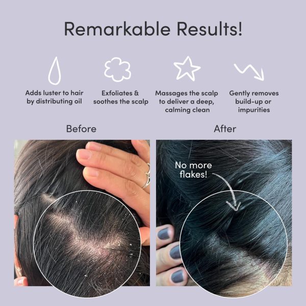 Jupiter Exfoliator Brush For Removing Dandruff & Build-Up - Detangling - Image 2