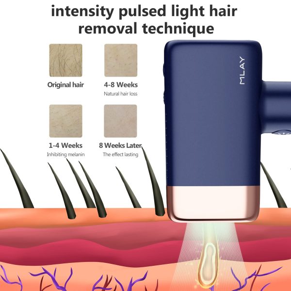 MLAY IPL Hair Removal Device, Ice Cooling Protection Laser Permanent Whole - Image 3