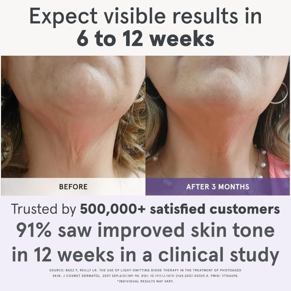 iRestore Illumina LED Neck & Chest Anti Aging Mask – for Smoother, Firmer - Image 2