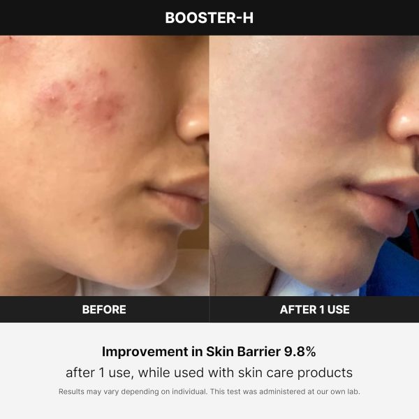 medicube Booster H - Korean Skincare Tool - Facial Glow Booster for - Image 4