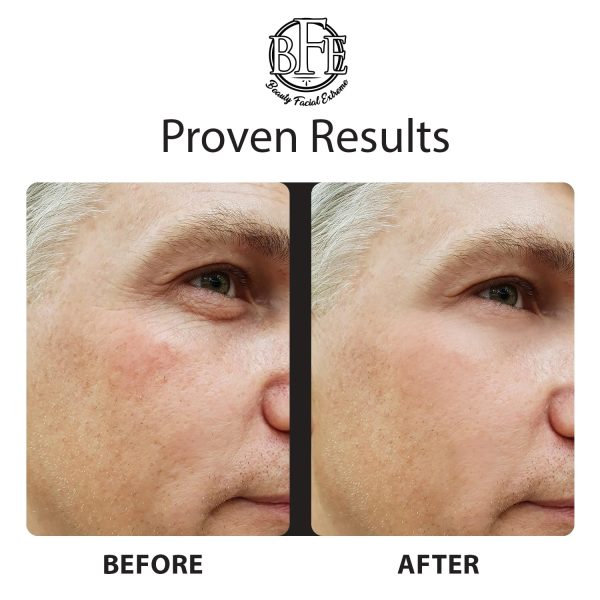 Instant Ageless Eye Cream - Reduces Under Eye Puffiness. Lift Technology to - Image 6