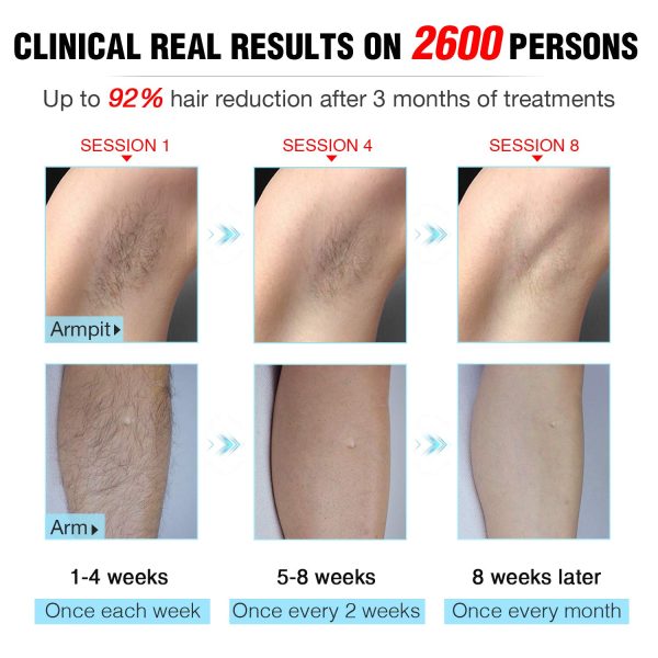 Laser Hair Removal Permanent, IMENE Painless IPL Hair Removal - Ideal for - Image 3