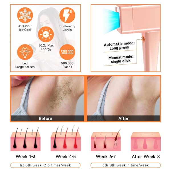 Laser Hair Removal with ICE Cooling, Painless Lasting Hair Removal Device, - Image 5