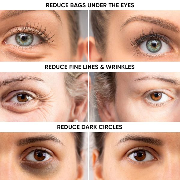 Instant Ageless Eye Cream - Reduces Under Eye Puffiness. Lift Technology to - Image 3