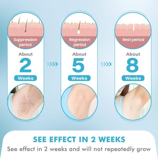 at-Home Hair Removal for Women and Men, DOPI Painless Hair Removal Device - Image 3