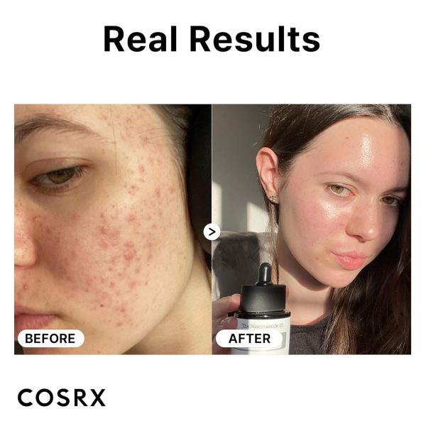 COSRX 15% Niacinamide Face Serum, 0.67 fl oz, Pore Minimizer Serum for Face - Image 4