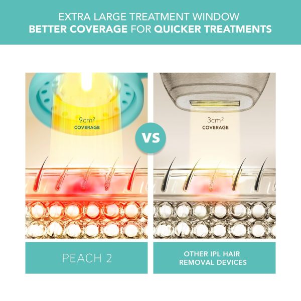 FOREO PEACH 2 IPL Hair Removal Device - Fast & Pain free Permanent Hair - Image 3