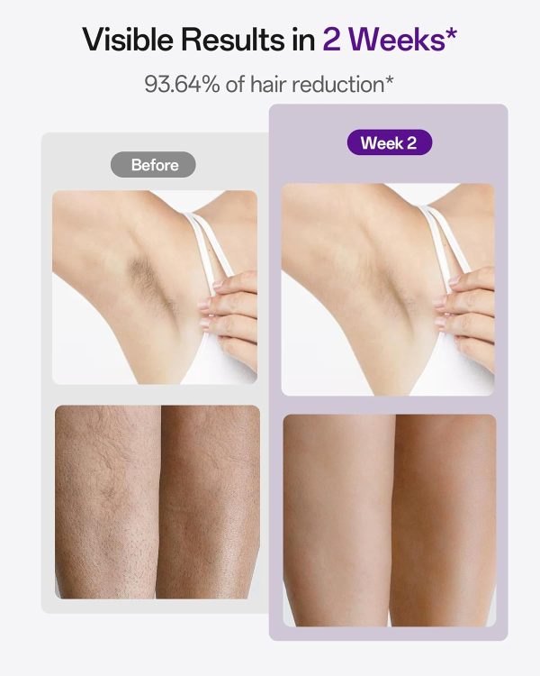 Laser Hair Removal, 40°F Sapphire Ice Cooling IPL Hair Removal Device for - Image 4