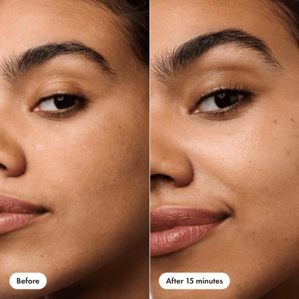 HERO COSMETICS Rescue Patch – The Moisturizing Cream Patch for Post-Blemish - Image 7