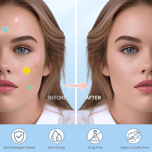Pimple Patches for Face, Hydrocolloid Acne Patches, Cute Star Zit Covers, - Image 4