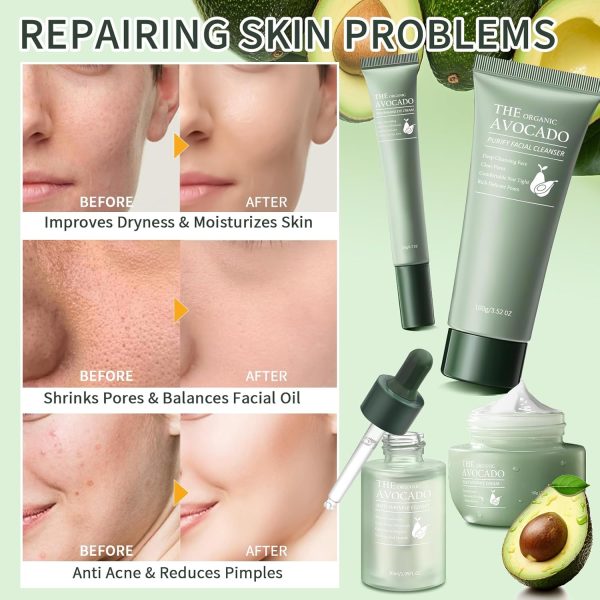 Avocado Skin Care Set, Skincare Gifts Kits For Hydrating Skin, Anti Aging - Image 5
