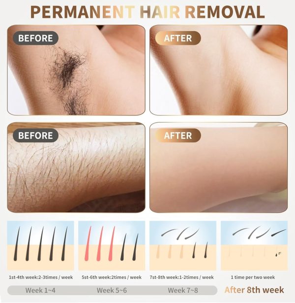 Home Use Beauty Device Hair Remover for Women and Men Best Whole Body - Image 4