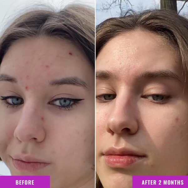 Good Molecules Niacinamide Serum - 10% Niacinamide Balancing B3 Facial - Image 4