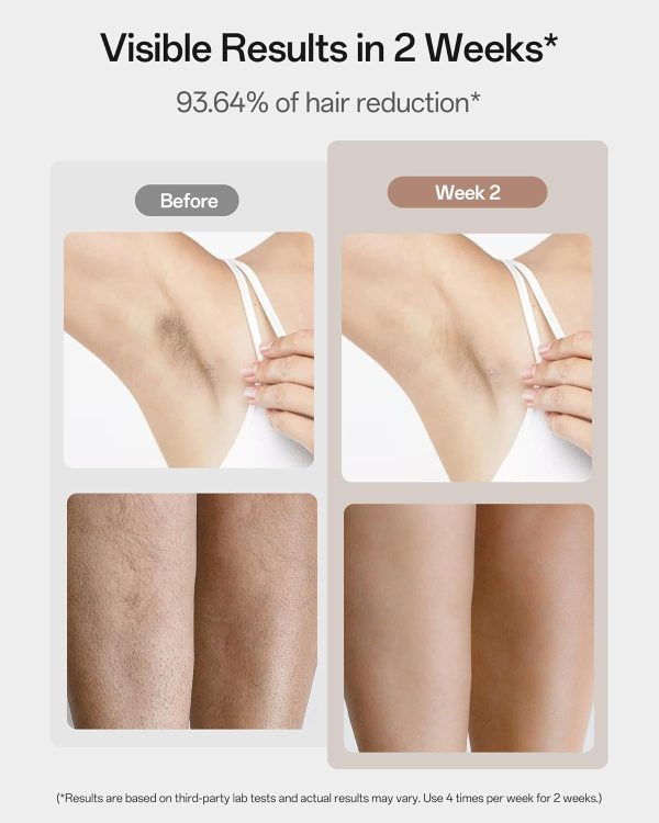 Laser Hair Removal, 40°F Sapphire Ice Cooling IPL Hair Removal Device for - Image 3