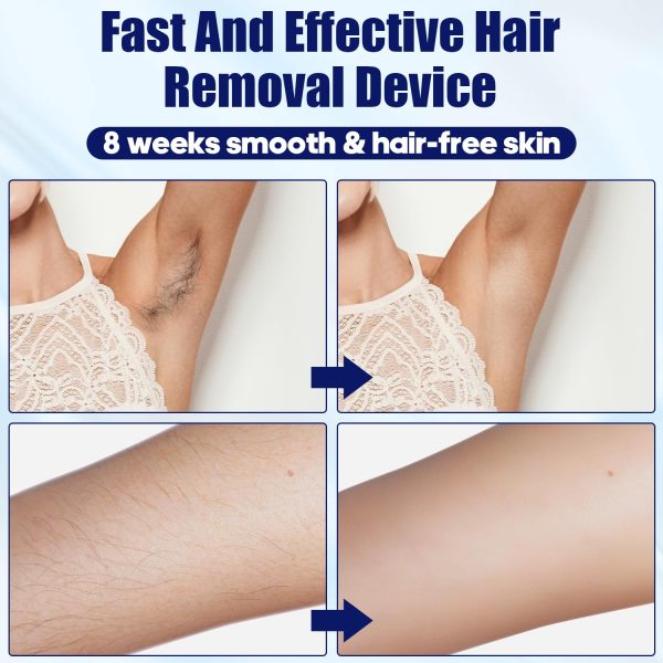 Portable Facial Hair Removal Device for Women & Men,TUMAKOU ICE Cool Hair - Image 4