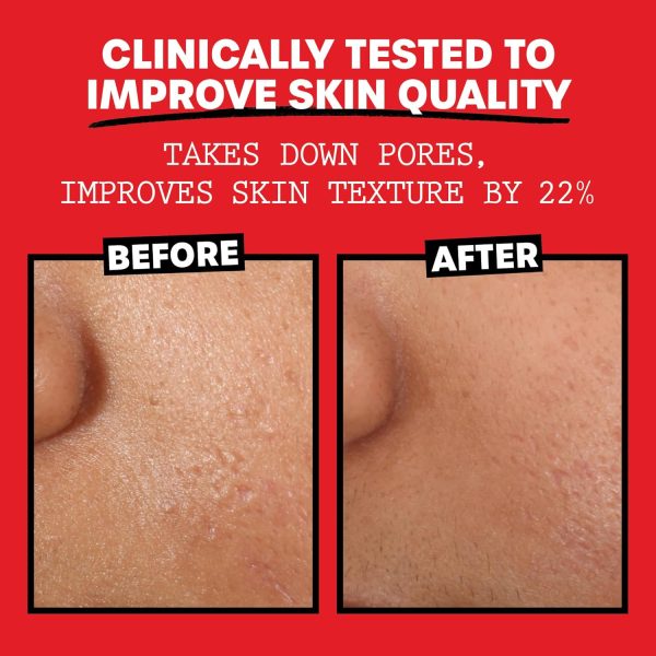 Thayers Alcohol-Free Rose Petal Witch Hazel Facial Toner for Glowing Skin, - Image 5